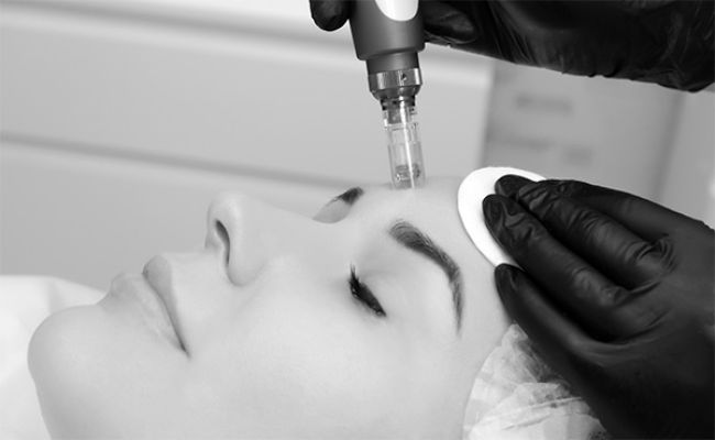 Microneedling Pfaffenhofen Shine & Glow